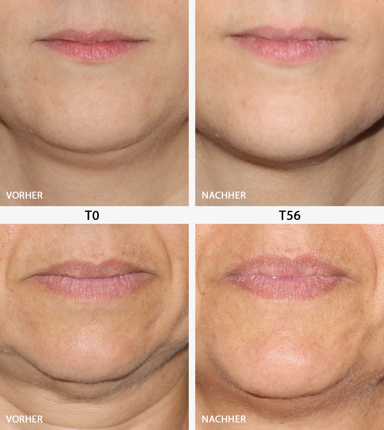 ファンデーション EISENBERG serum Face refining serum |Sérum Affinant Visage – EISENBERG Paris